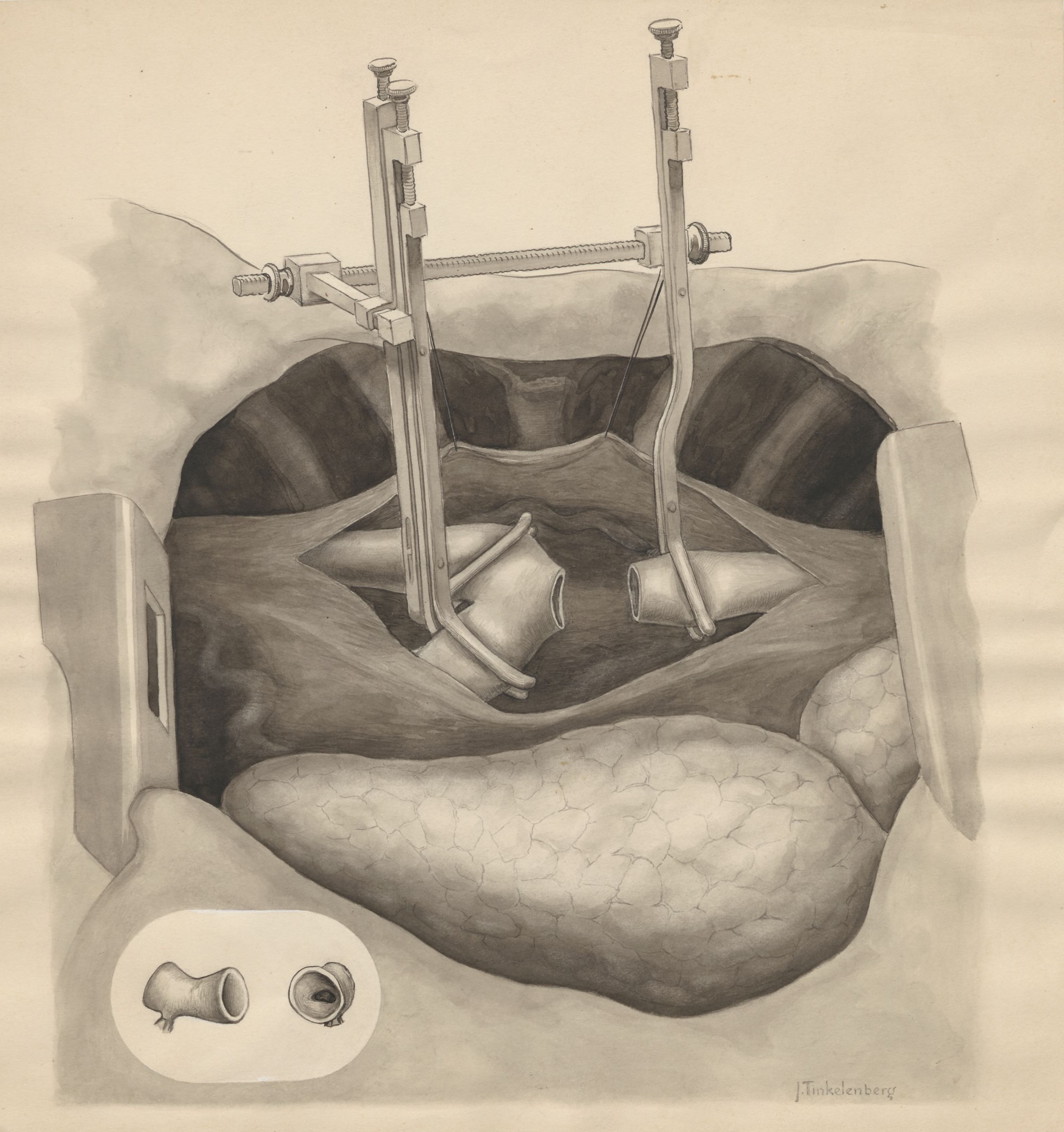Part of the heart and circulatory system