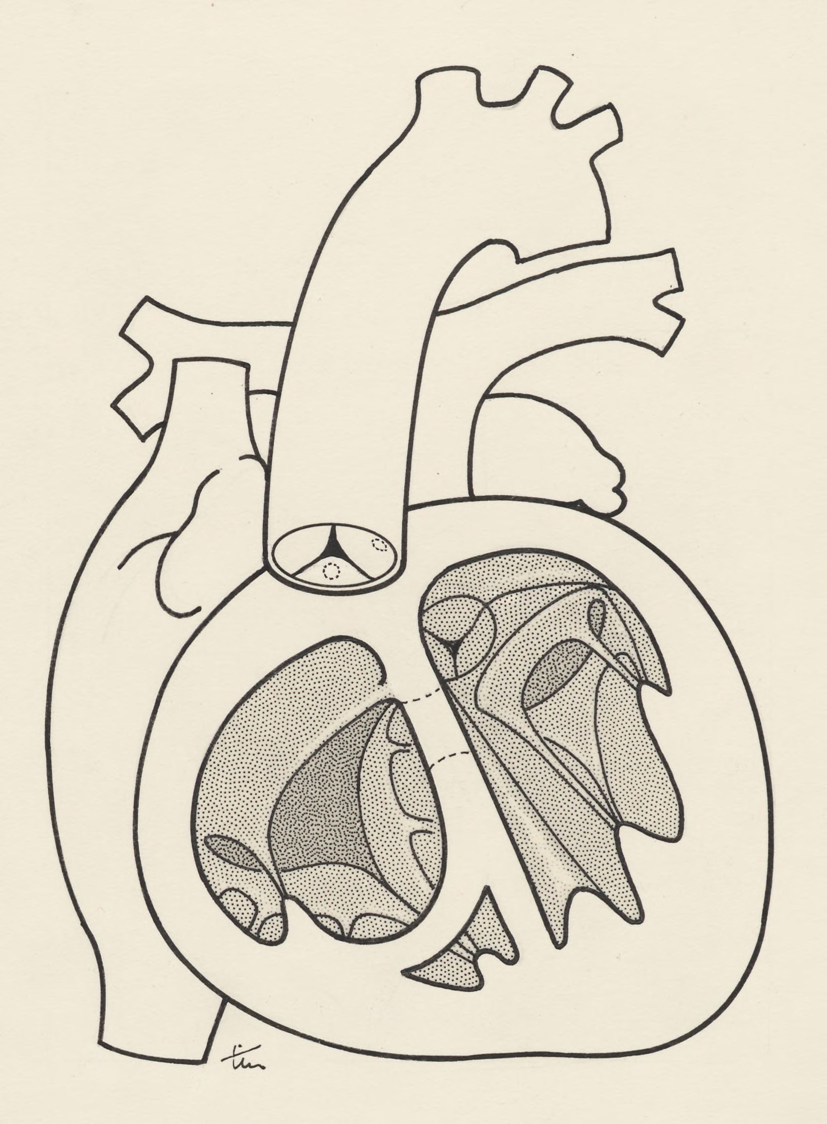 Schematic representation of the heart and circulatory system