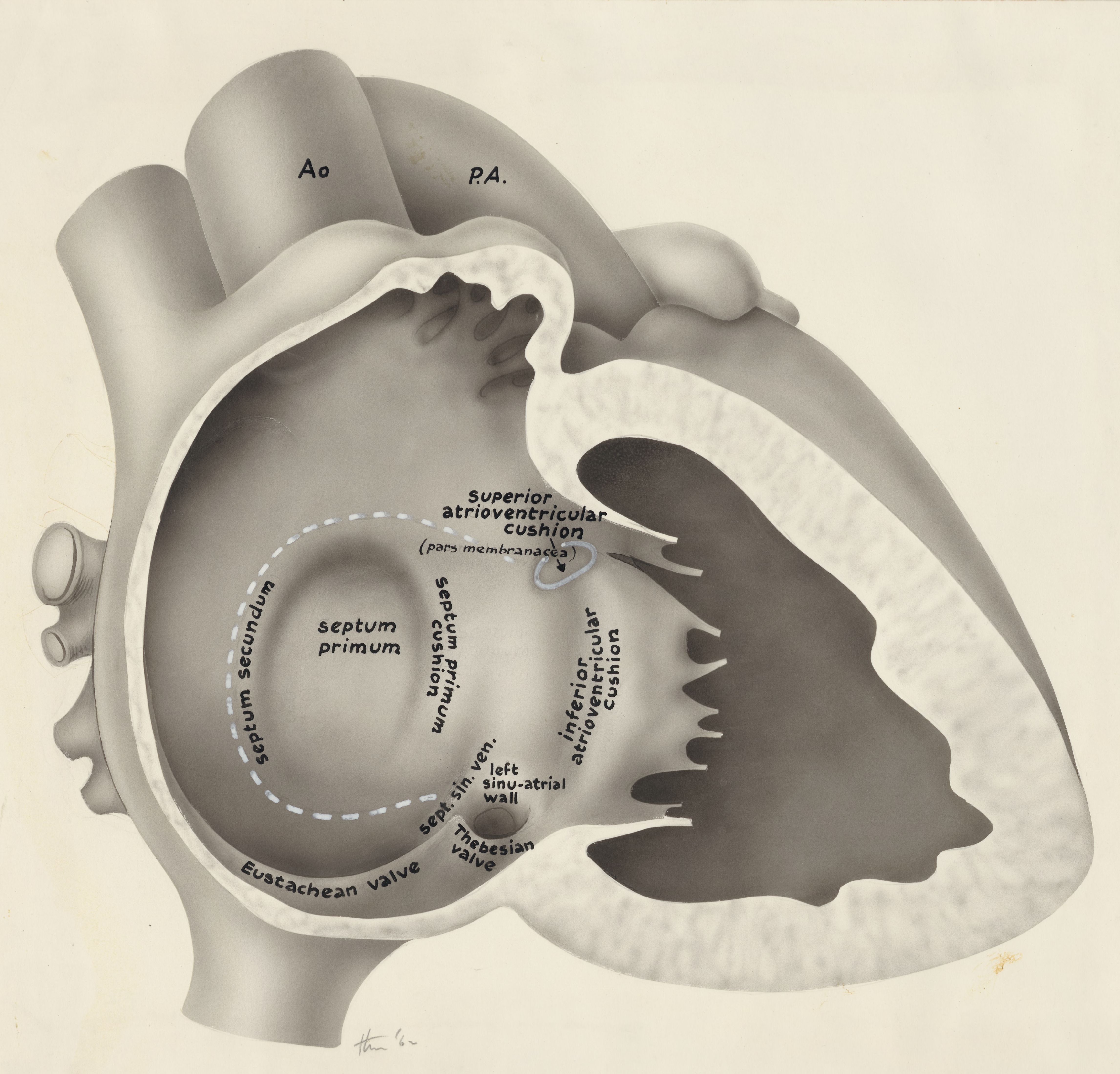 Embryonic heart