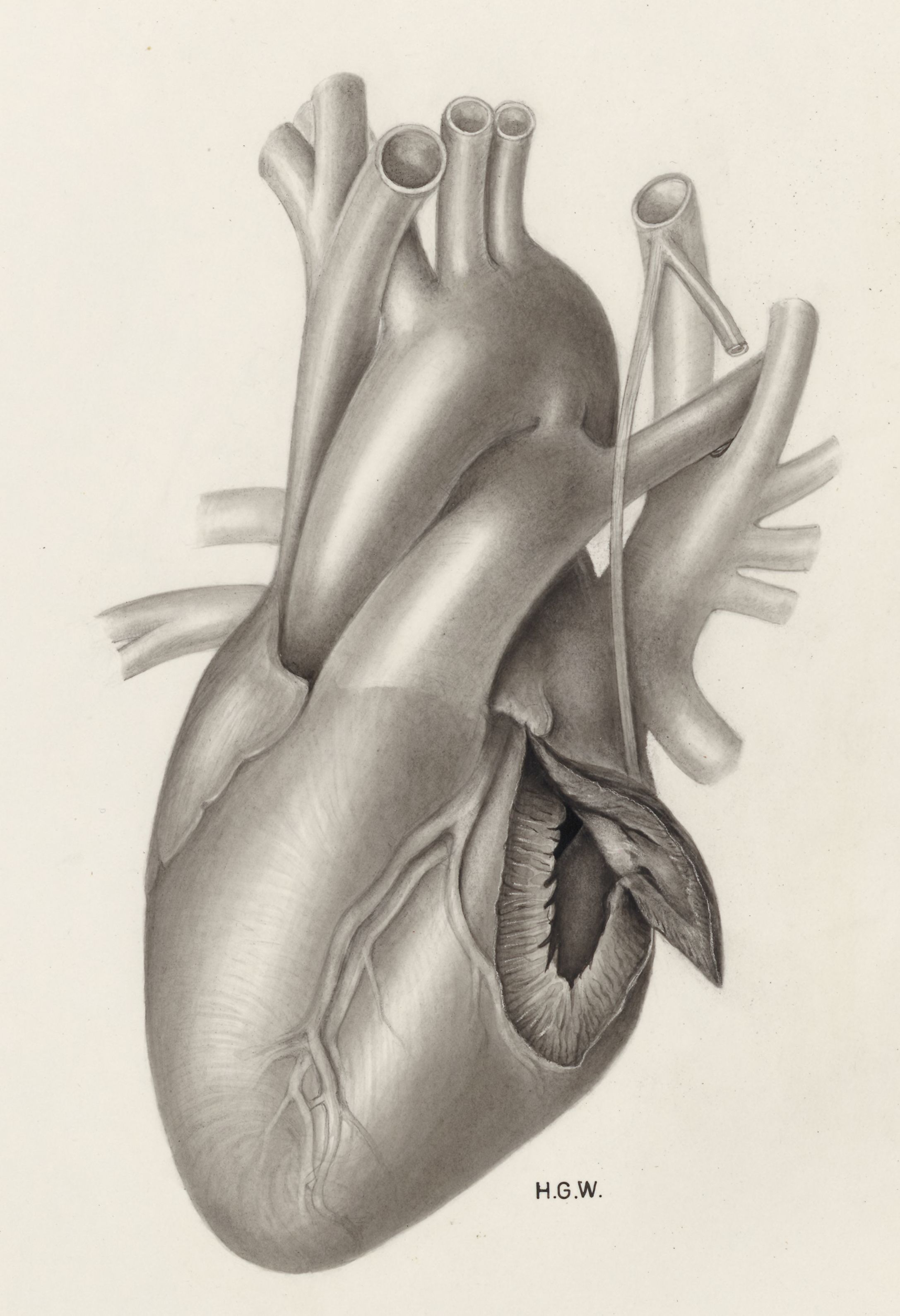 Heart