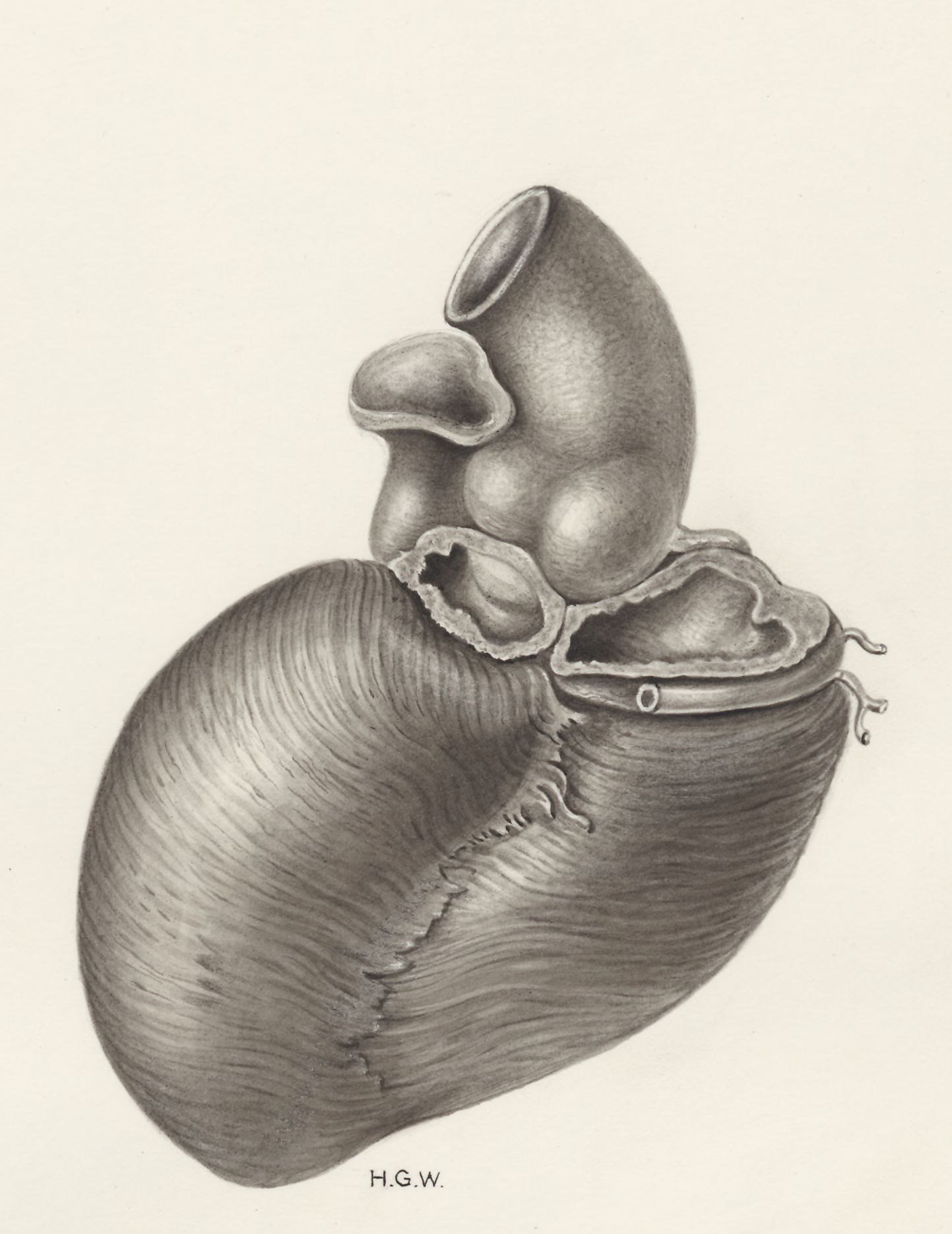 Heart