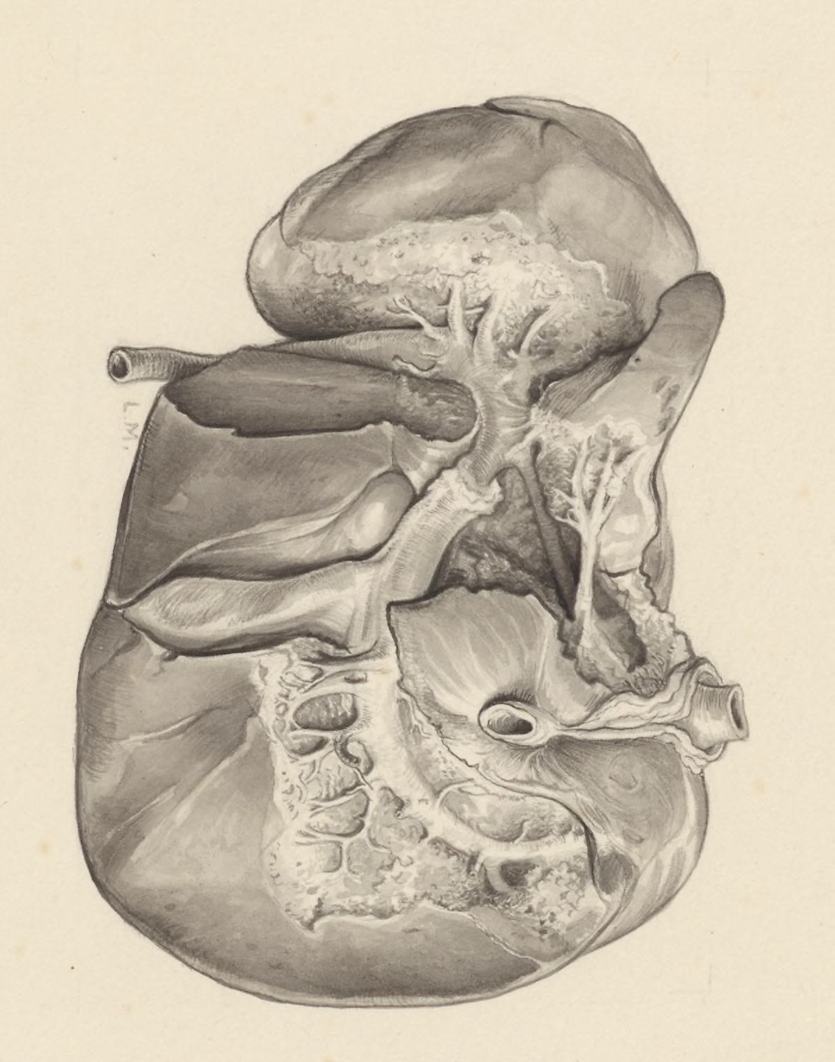 Liver