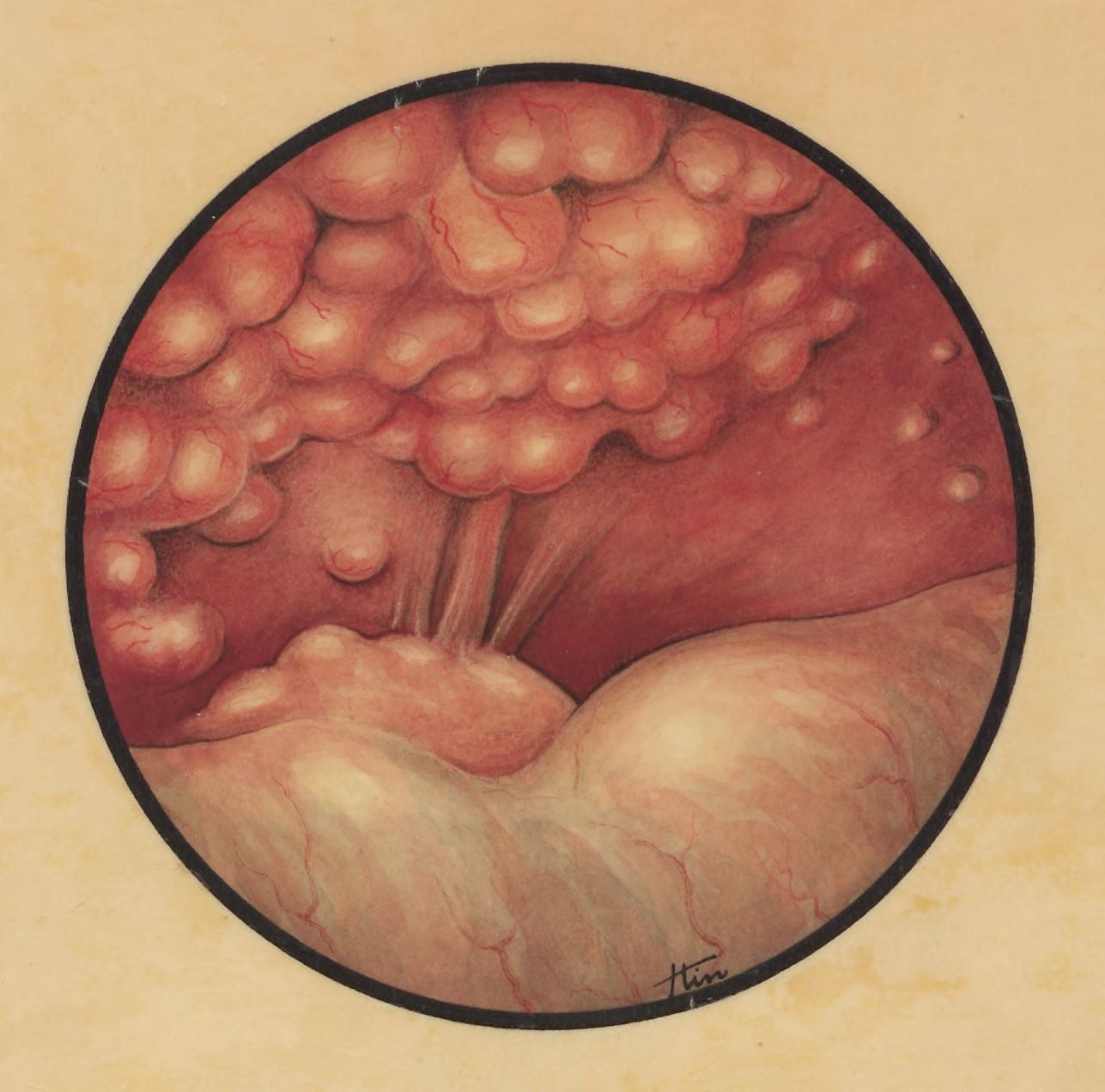 Embryonic heart