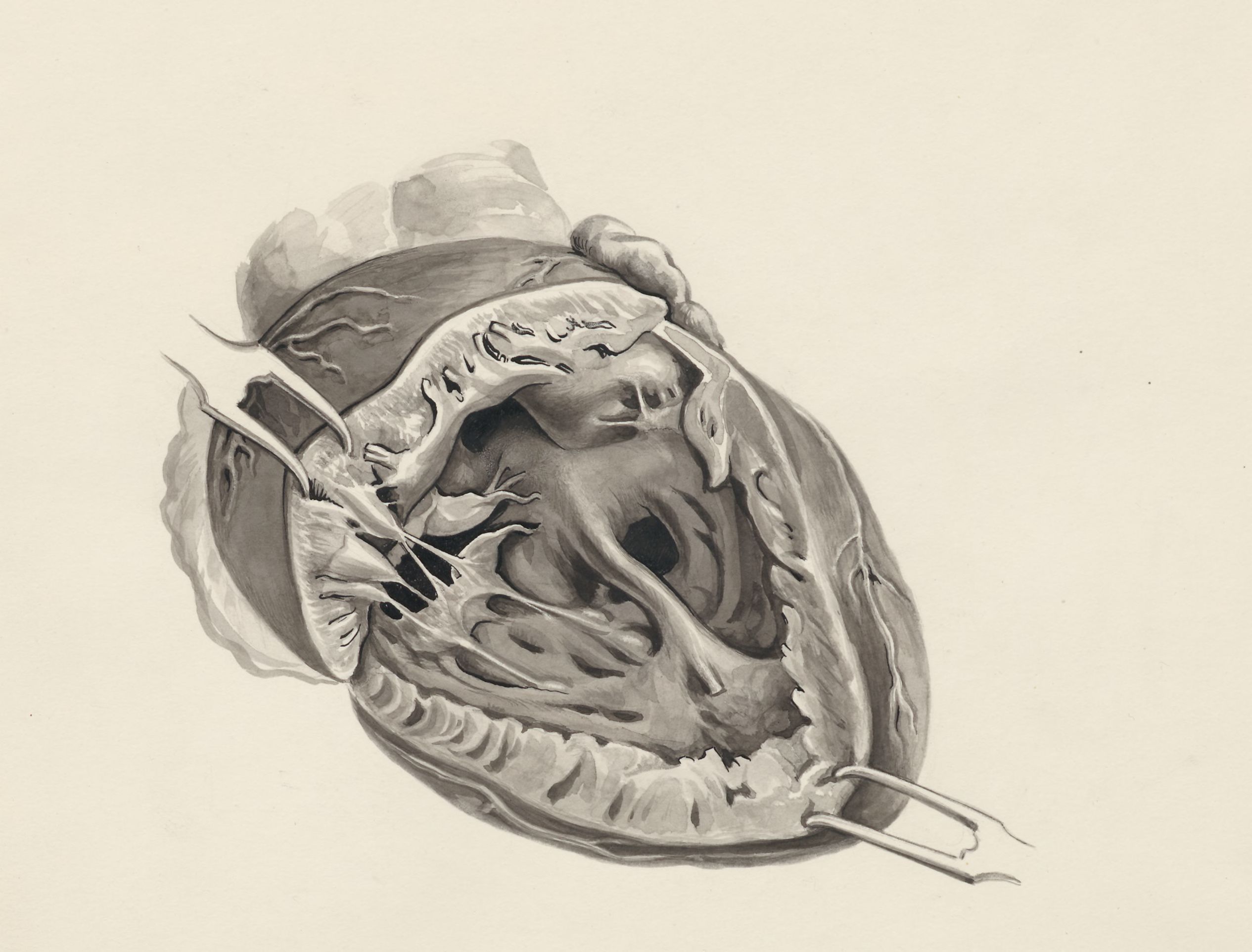 Embryonic heart
