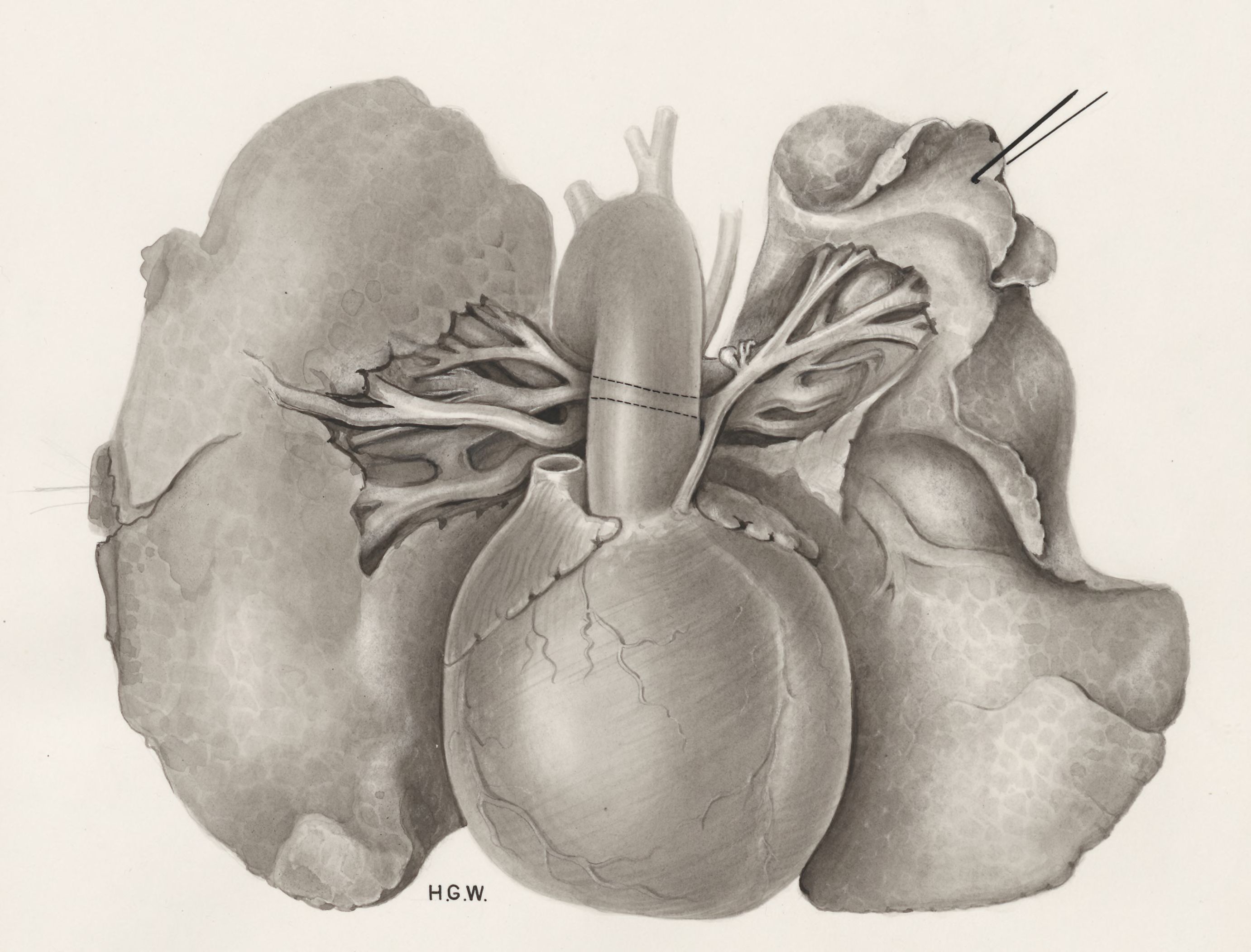 Heart and adjacent organs