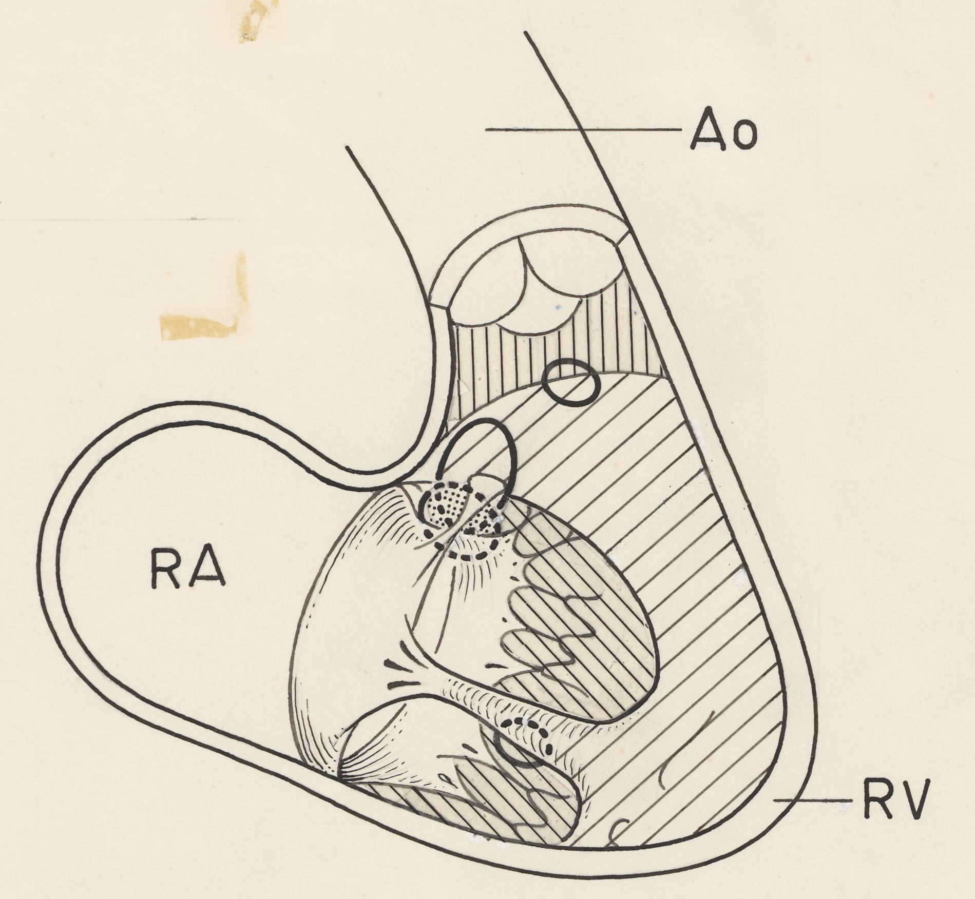 Schematic representation of the cardiovascular system